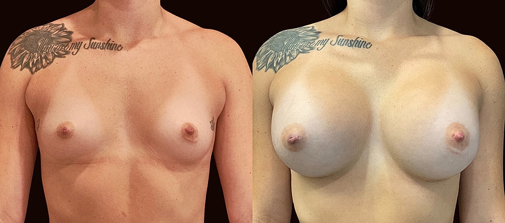 Before and after body image comparison.